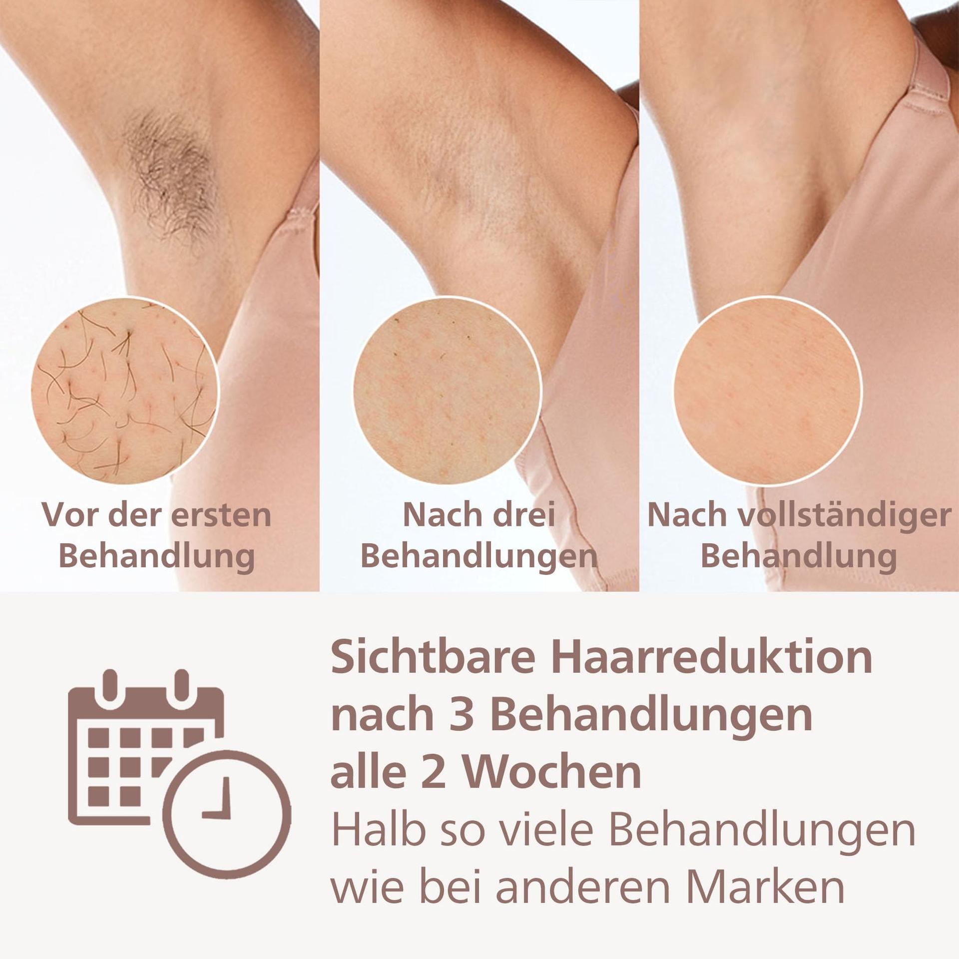 Philips Lumea 8000 seeria IPL-karvaeemaldusseade, alternatiiv laserkarvaeemaldusele, SenseIQ tehnoloogia, 4 otsikut kehale, näole, bikiinipiirkonnale ja kaenlaalustele, mudel BRI948/00 – pakend ja tarvikud