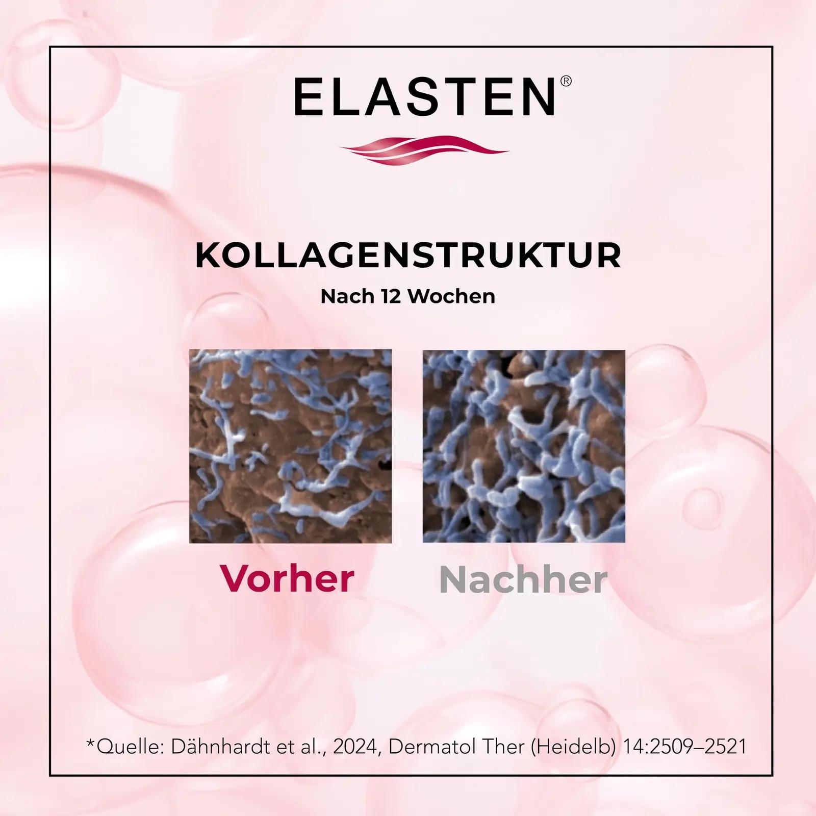 Elasten vedel kollageen 28×25 ml – naha tugevdamiseks – lisavaade