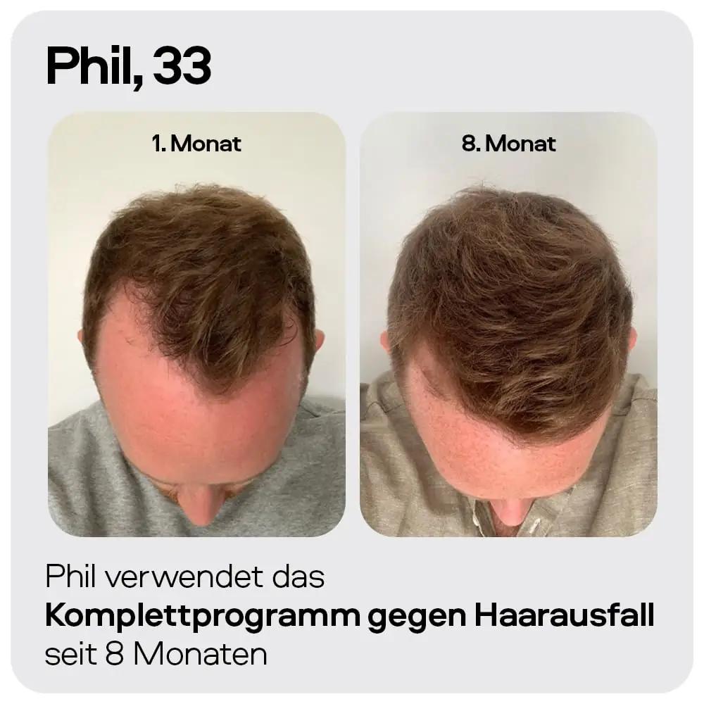 Sons meeste taastav šampoon — DHT-blokeeriv ja tugevav – lisavaade