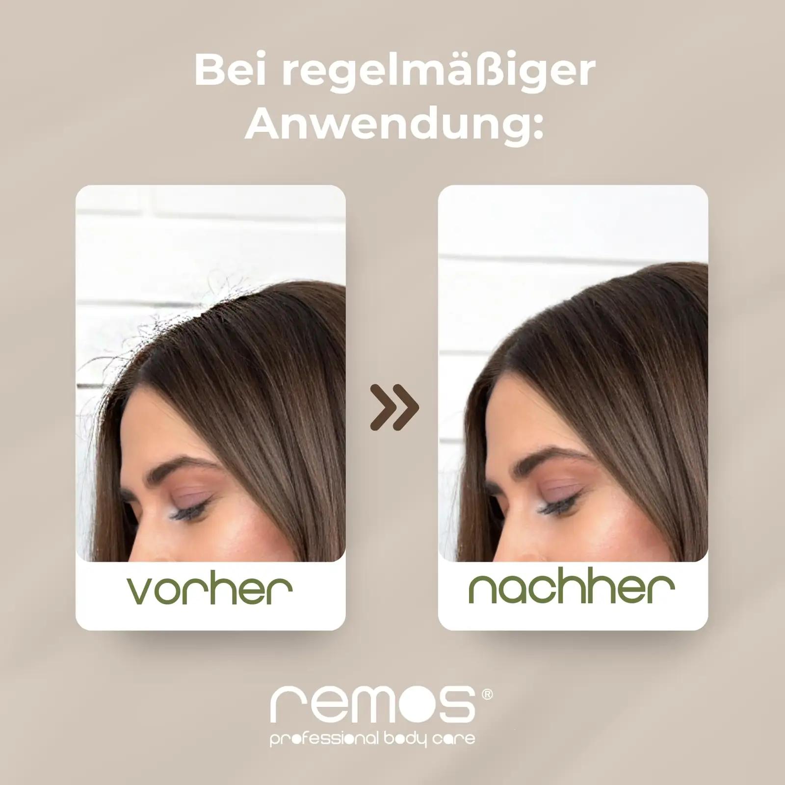 remos professional body care puitjuuksehari anti-murdumine – kasutusnäide