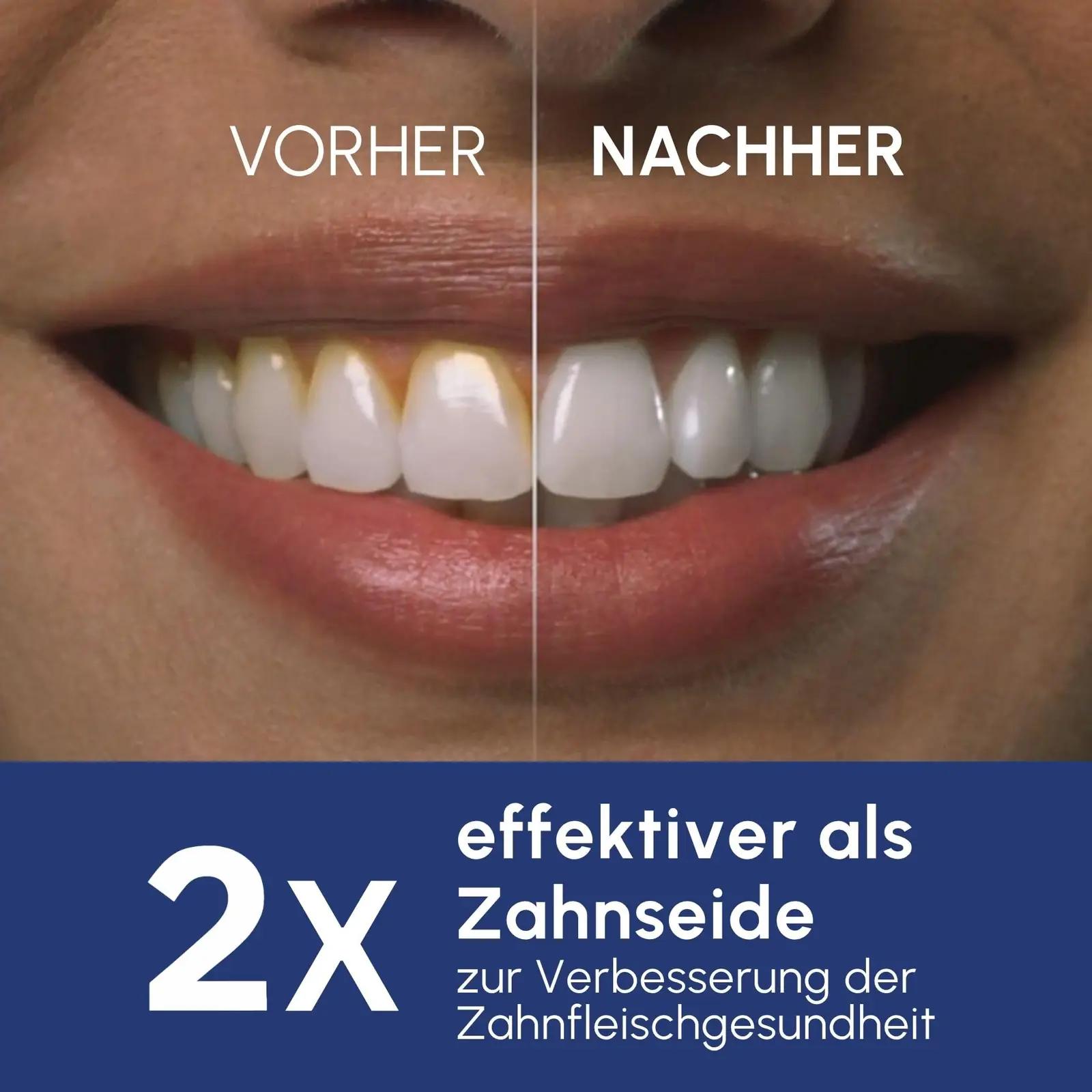 Waterpik Ultra Professional – suuvesi‑aparaadid – pakend ja tarvikud