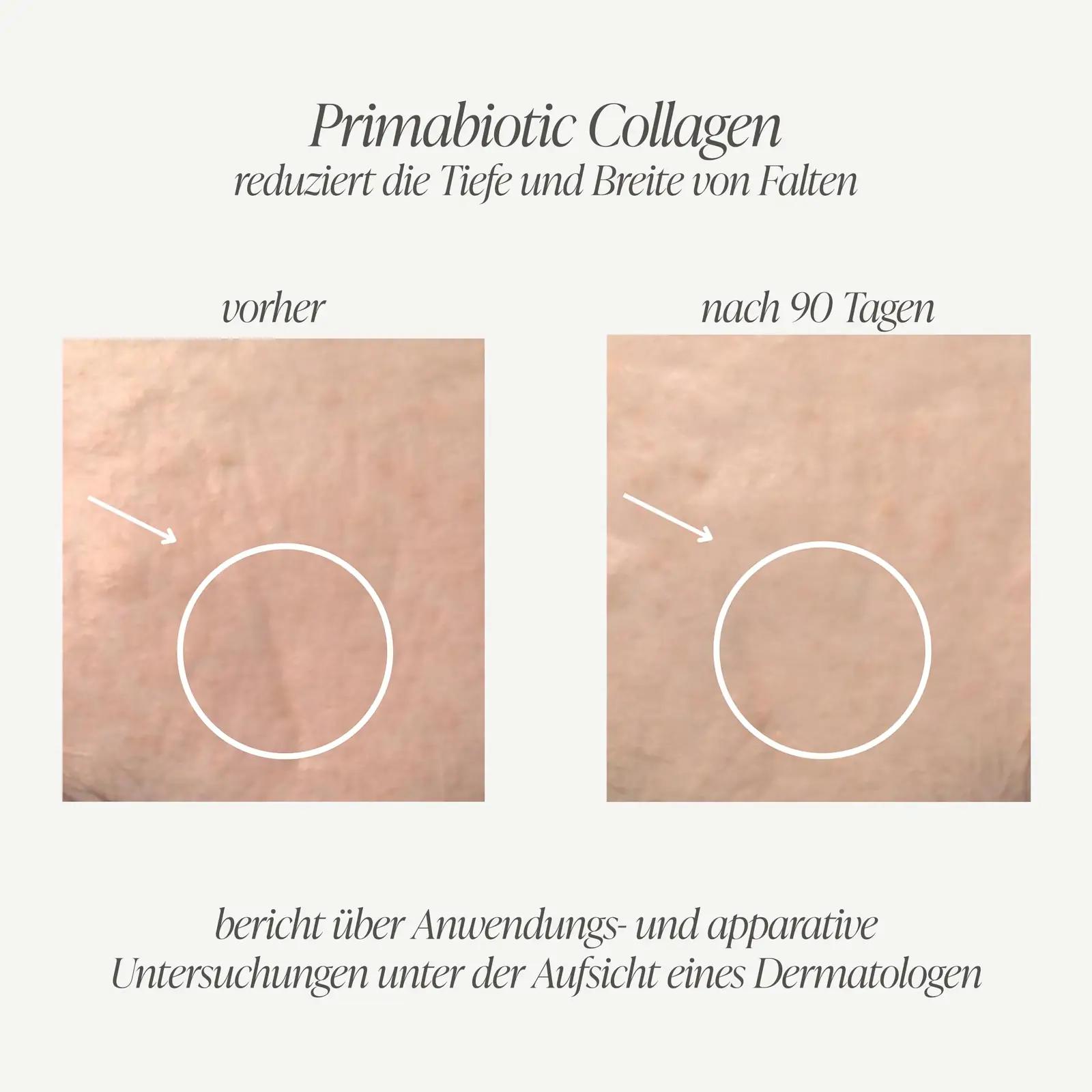PRIMABIOTIC vedel kollageen 10 000 mg naha ja juuste jaoks – pilt 6