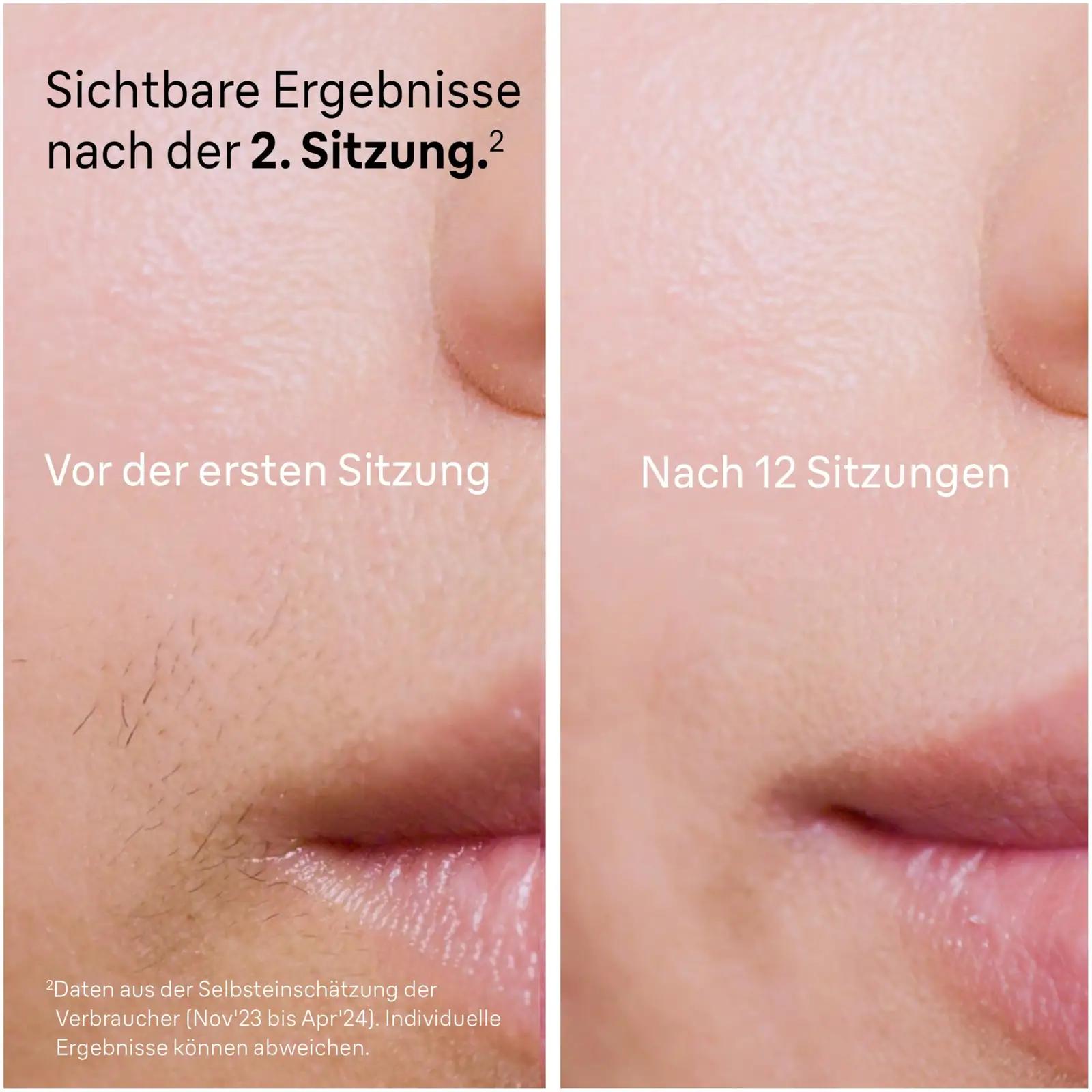 Braun IPL kodune karvade eemaldaja — valge-kuldne komplekt – pakend ja tarvikud